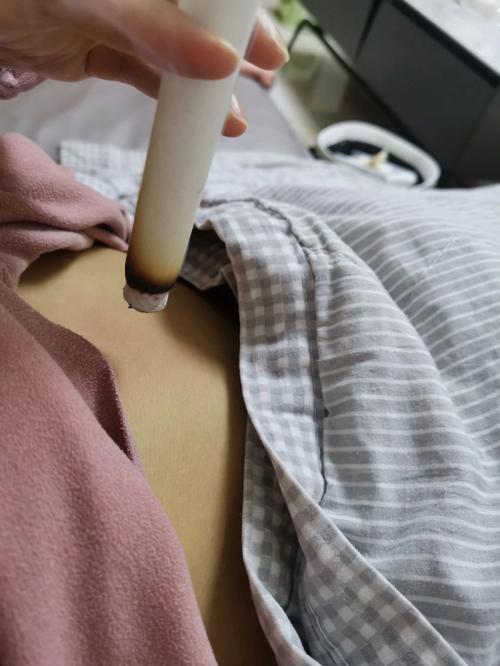在杭州浩然国际美容院艾灸瘦身被烫伤 退款半年未到账(艾灸女士美容院)