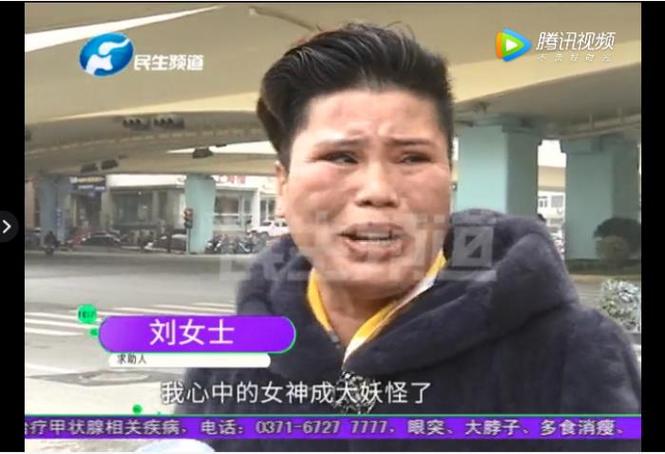 又一起_女子整容失败崩溃大哭:以前都叫我万人迷_现在说我像妖怪……(萬人迷整容妖怪)