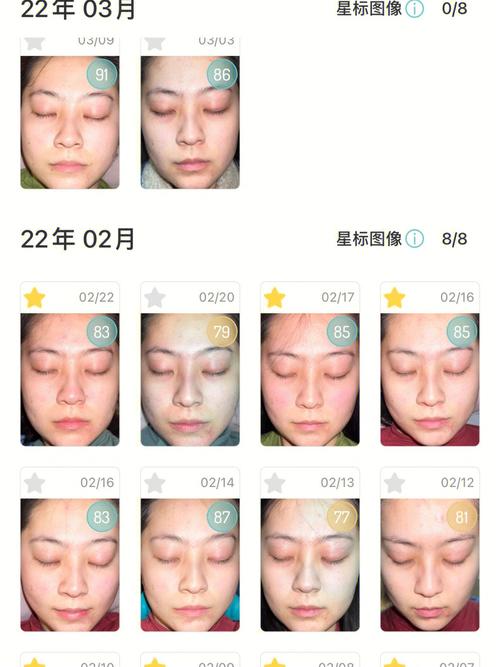 春节不回家 ?整形美容“扎堆忙”_专家提醒:需选择正规医院并重视术后护理(吸脂整形手術)