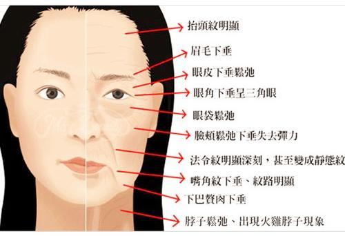 整形课堂:为何你的脸变得又松又垮?(面部整形下垂)
