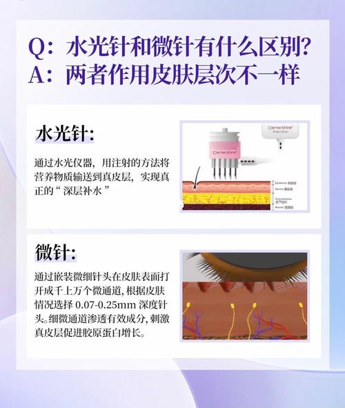 水光针真的如此神奇吗?(水光皮膚註射)