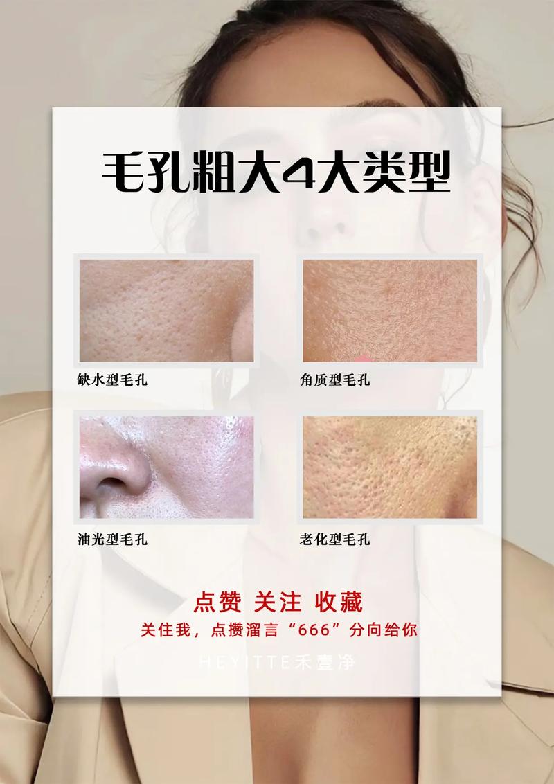 哪些医美项目可以改善毛孔粗大?(毛孔皮膚改善)