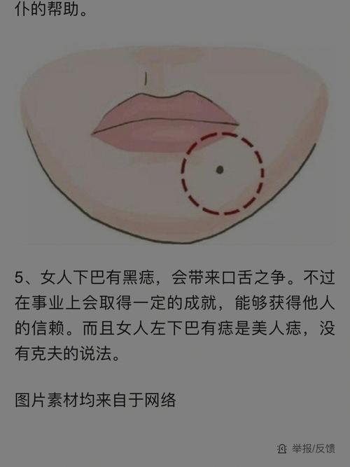 女人脸上的美人痣_一般长在四个地方_天生美丽而不自知(女人長在而不)