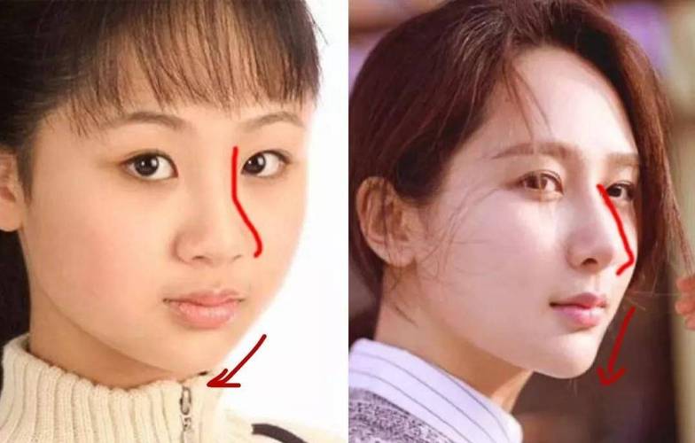 杨紫去美容院干什么了?居然被人说去整容了(被人美容院整容)