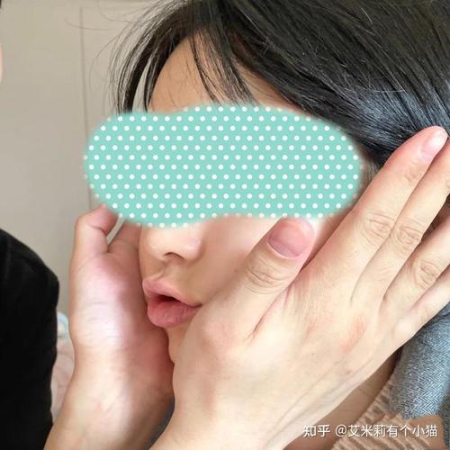 掏了室友脸上一颗大黑头_留了一个大洞_该怎么办?(黑頭大洞傷口)